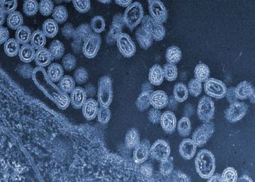 Pandemia y otras plagas