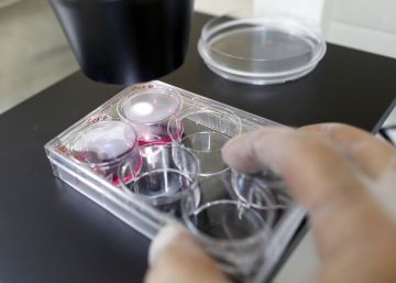 Aprobado el primer tratamiento con células externas al paciente