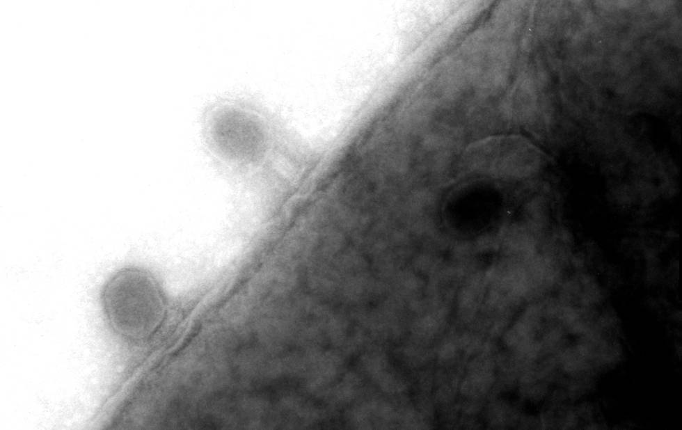 Virus fagos en la membrana de una bacteria 'E. coli'.