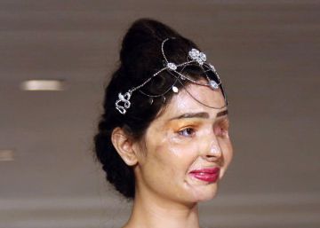 Reshma, vítima de ataque com ácido, redefine a beleza em Nova York