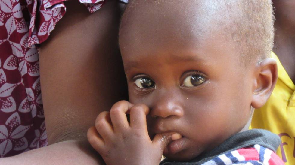Mamadou Bâ, de 20 meses, se agarra al brazo de su madre. El pequeño sufrió malnutrición cuando solo tenía nueve meses y ahora ha vuelto a recaer. Su madre, Fatoumata Bâ, trata de sacar adelante a sus ocho hijos con los pocos ingresos que le reporta la venta de telas. Su padre, Seydou Bâ, pasa la mayor parte del año pastoreando el ganado, cabras y corderos, en lugares cada vez más alejados.
