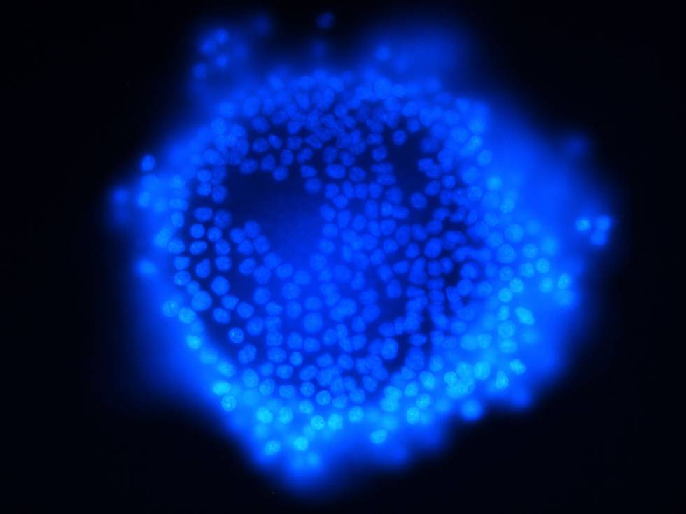 Ovocito de cerdo rodeado de células granuladas