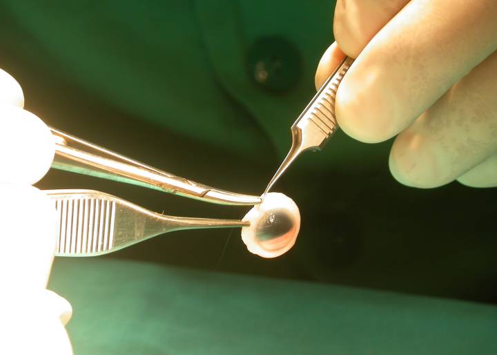 Luz verde al primer tratamiento con células madre de la UE Luz verde al primer tratamiento con células madre de la UE