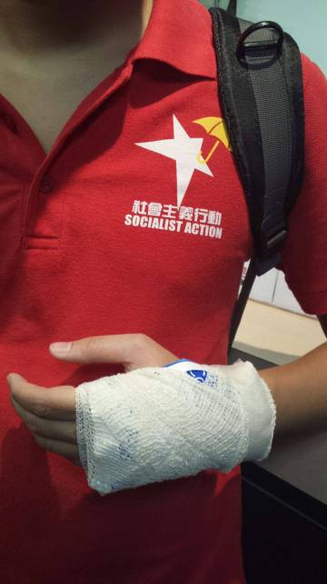 Uno de los manifestantes chinos, que afirma haber recibido atención hospitalaria tras el altercado.