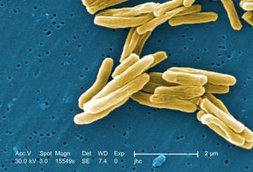 La 'Mycobacterium tuberculosis' vista con un microscopio electrónico.