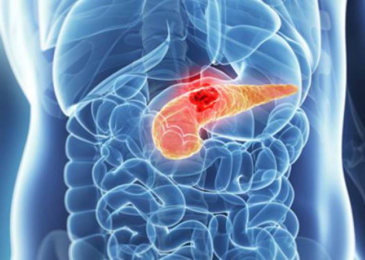 Una molécula detiene el crecimiento del cáncer de páncreas en ratones Una molécula detiene el crecimiento del cáncer de páncreas en ratones