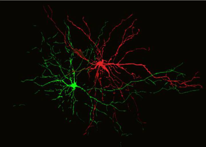 Así se ve el placer y el dolor en el cerebro Así se ve el placer y el dolor en el cerebro