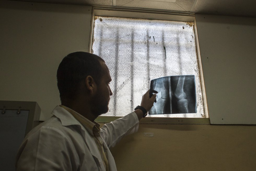 El médico Ángel Molina, estudiando una radiografía en su consulta. Asegura que la implicación del médico cubano viene de tener muy arraigado el juramento Hipocrático y la sensible solidaridad con los países donde más necesitan ayuda médica.