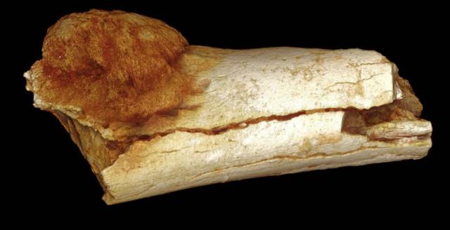 Representación del hueso del pie.