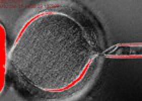 20 años de la oveja Dolly: ¿por qué los clones mueren jóvenes? 20 años de la oveja Dolly: ¿por qué los clones mueren jóvenes?