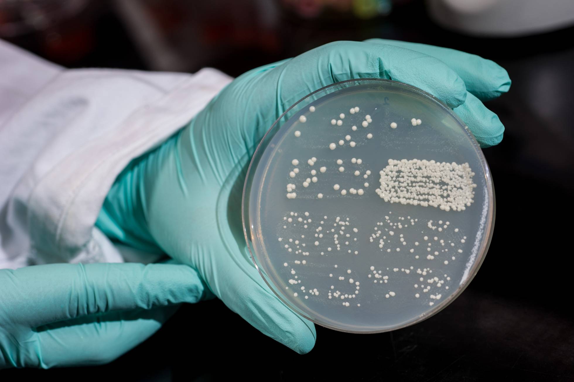 Un cultivo de levadura.