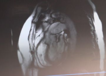 ¿Por qué las mujeres tardan 16 minutos más en identificar un infarto? ¿Por qué las mujeres tardan 16 minutos más en identificar un infarto?