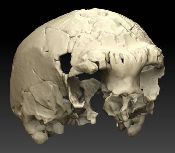 Reconstrucción del cráneo en base a un escáner