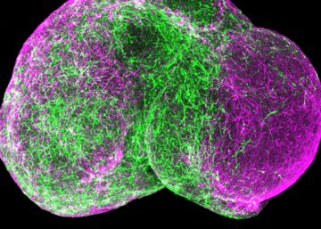 Las células madre se organizan imitando al cerebro humano