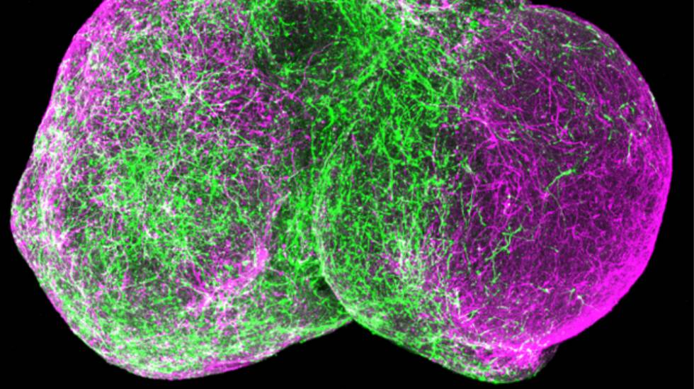 Dos esferoides humanos ensamblados, el ventral a la izquierda, el dorsal a la derecha. Las neuronas inhibidoras (verde) están migrando a la zona dorsal y formando circuitos allí.
