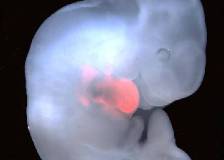 Un paso hacia el cultivo en cerdos de órganos humanos Un paso hacia el cultivo en cerdos de órganos humanos