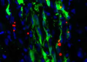 Las células madre se organizan imitando al cerebro humano