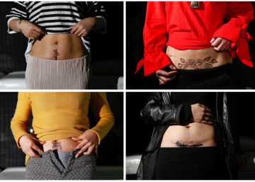 Tatuajes gratis para ocultar la cicatriz de la cesárea
