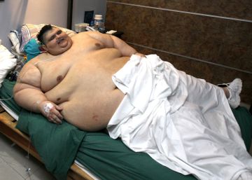 El hombre más obeso del mundo, operado con éxito para reducirse el estómago El hombre más obeso del mundo, operado con éxito para reducirse el estómago