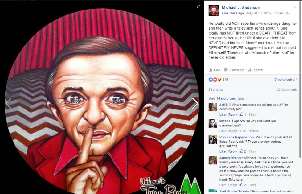 10 cosas muy locas del enano de 'Twin Peaks' por las que no continúa en la serie