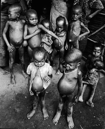 Niños hambrientos durante la guerra de Biafra.