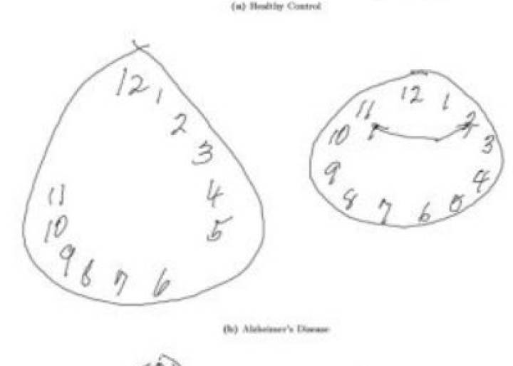 La inteligencia artificial mejora el diagnóstico de enfermedades mentales La inteligencia artificial mejora el diagnóstico de enfermedades mentales