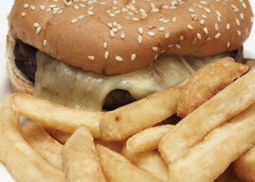 ‘Junk food’ inflama o cérebro e aumenta o apetite ‘Junk food’ inflama o cérebro e aumenta o apetite