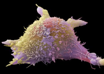 En busca de una vacuna contra cada cáncer En busca de una vacuna contra cada cáncer