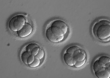 Cientistas eliminam pela primeira vez gene da morte súbita em embriões humanos