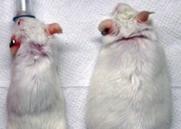 Trasplantes de piel contra la diabetes y la obesidad