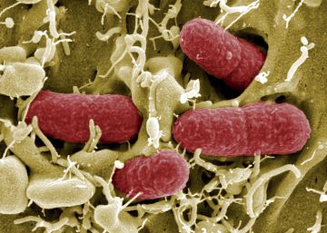 Mejoran el sistema inmune de personas con VIH con el trasplante de bacterias intestinales Mejoran el sistema inmune de personas con VIH con el trasplante de bacterias intestinales