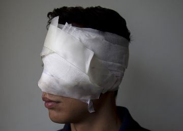 Torture victims in Venezuela testify to brutality of Maduro regime Torture victims in Venezuela testify to brutality of Maduro regime