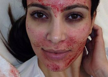 Bofetadas y pies despellejados: así son los tratamientos de belleza sadomaso