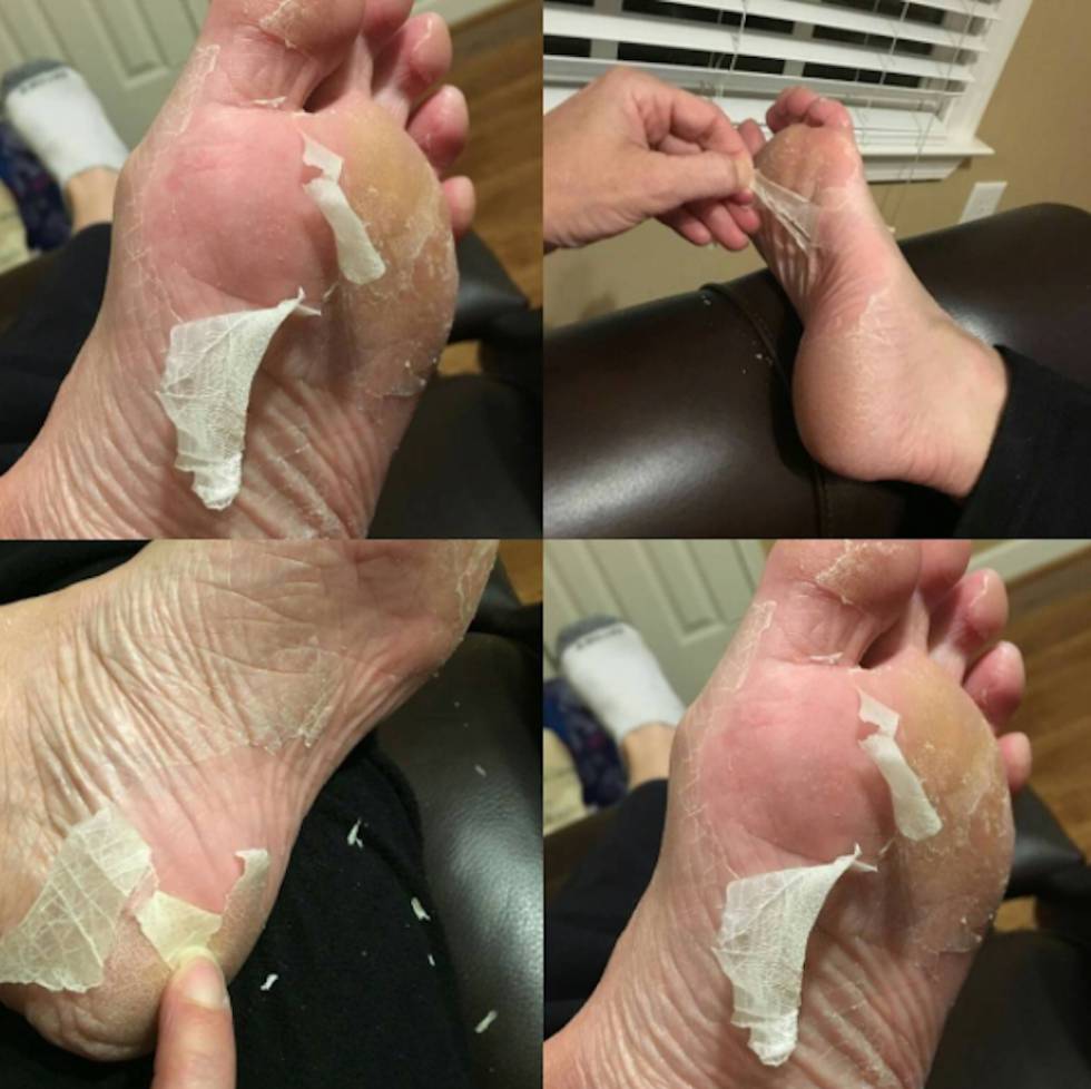 Bofetadas y pies despellejados: así son los tratamientos de belleza sadomaso