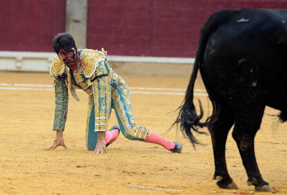 Cayetano Rivera, tras ser corneado.