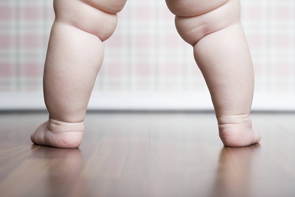 Enfermedades raras: los niños que nunca paran de comer