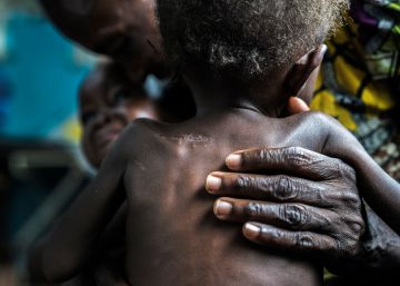 Sube el nivel de emergencia en la República Democrática del Congo