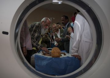 El cáncer de mama más antiguo del mundo