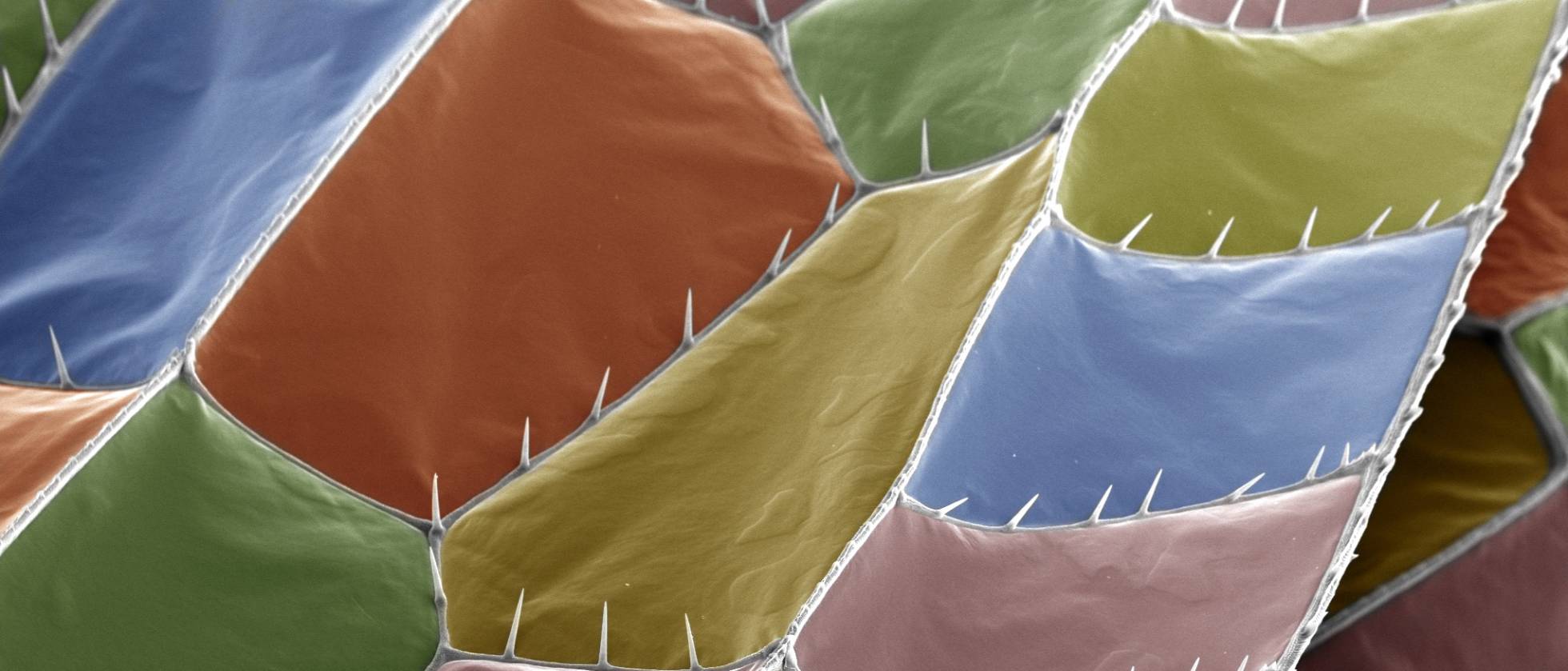 Microfotografía de las alas de una libélula.