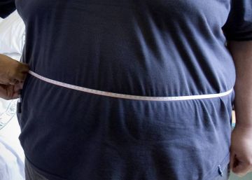 La obesidad en mujeres multiplica por 12 el riesgo de sufrir un cáncer