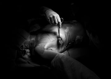 La mirada de un corresponsal de guerra al cáncer de mama