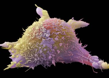 Inmunoterapia contra el cáncer: un nuevo paradigma