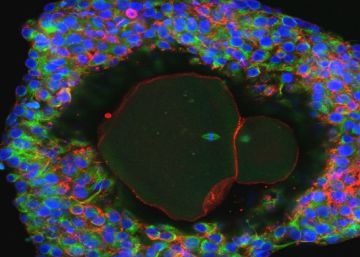 Desarrollados óvulos humanos por primera vez en el laboratorio