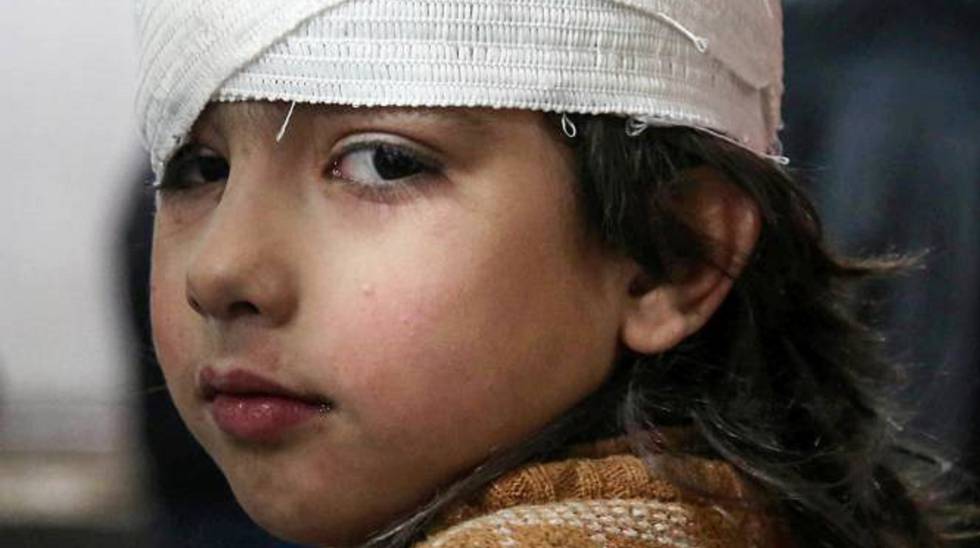 IMÁGENES DEL DÍA. Una niña siria se recupera en un hospital en Kafr Batna tras ser herida durante un bombardeo en Guta Oriental (Siria), el 21 de febrero de 2018.