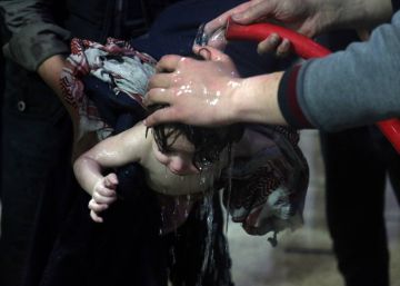 Un niño tratado en un hospital de Duma tras el supuesto ataque químico.