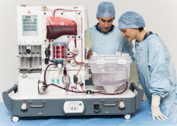 El ‘respirador artificial’ para órganos que promete revolucionar los trasplantes