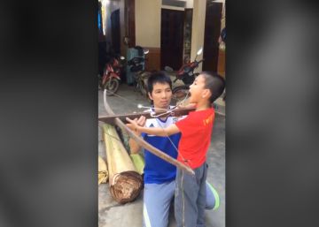 Un niño se saca un diente de leche con una ballesta en Vietnam