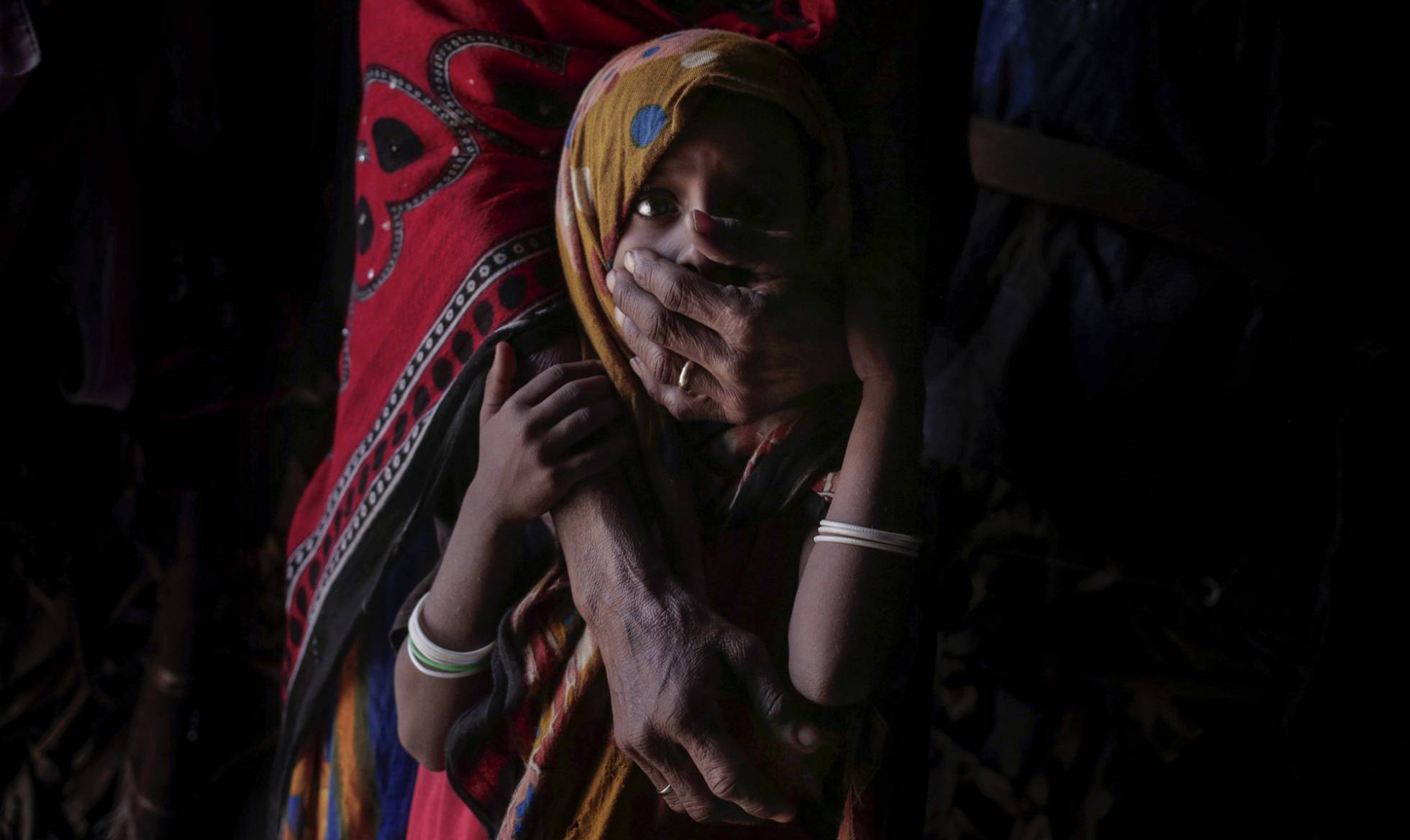 Una madre sostiene a su hija desnutrida, en Abyan, Yemen.