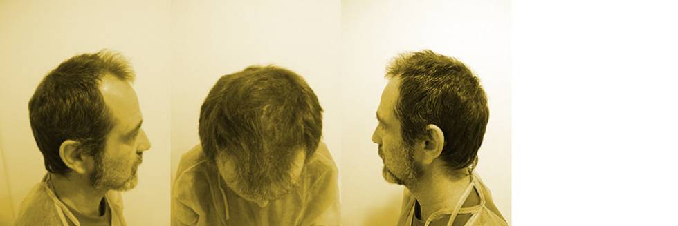 pelo