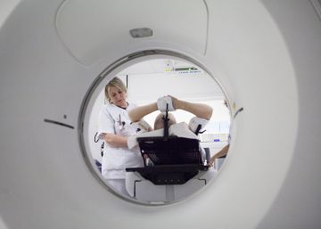 ¿Por qué la supervivencia al cáncer es hasta un 180% mayor en otros países?